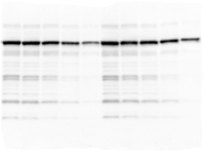 A blot with non-specific-bands – Western Blot Doctor