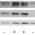 A blot with air bubbles – Western Blot Doctor - Protein Transfer Issues
